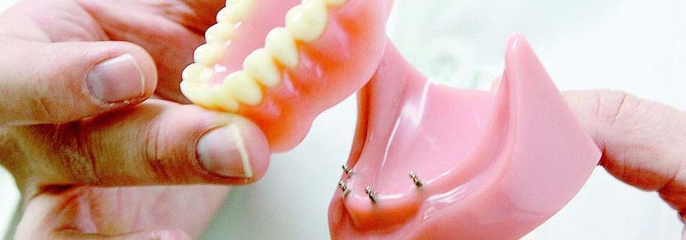 Pink Acid Queen Dentures Los Ebanos TX 78565